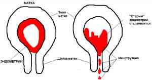 Обильные менструации (меноррагия): причины и симптомы, диагностика ...
